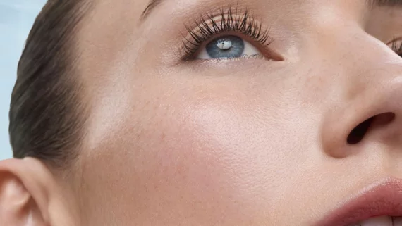 Woman with dry skin on her face