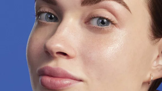 oily skin woman
