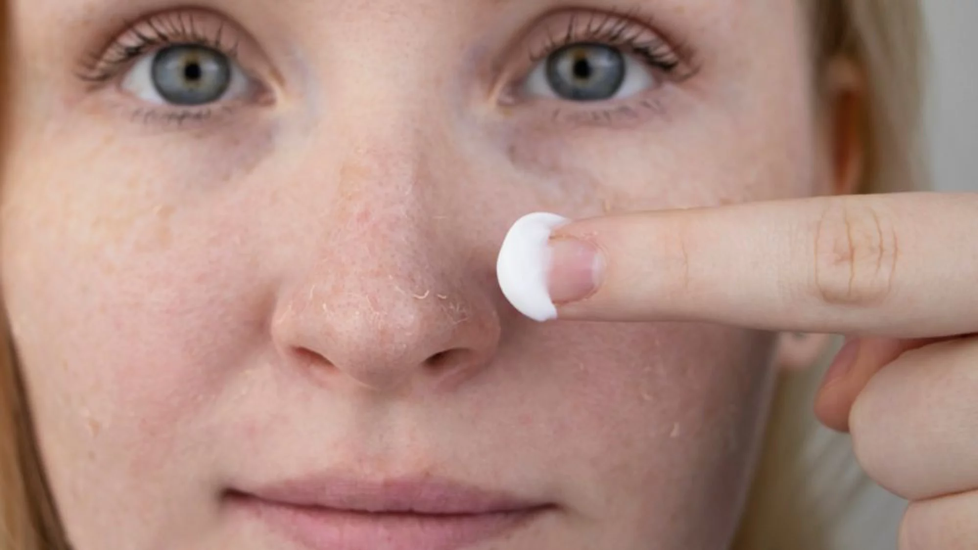 Frau mit trockener Haut im Gesicht