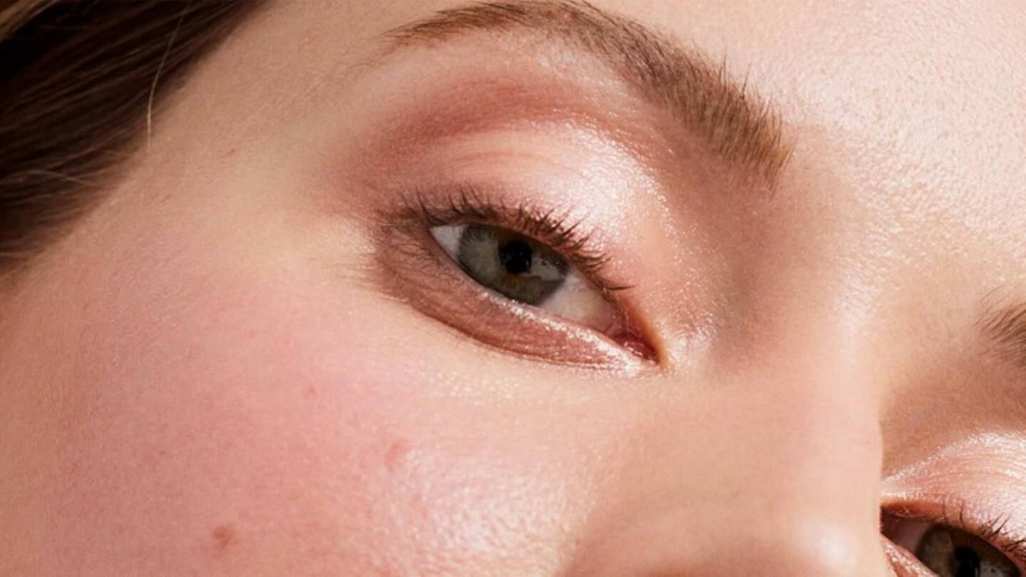 spots on woman face skin