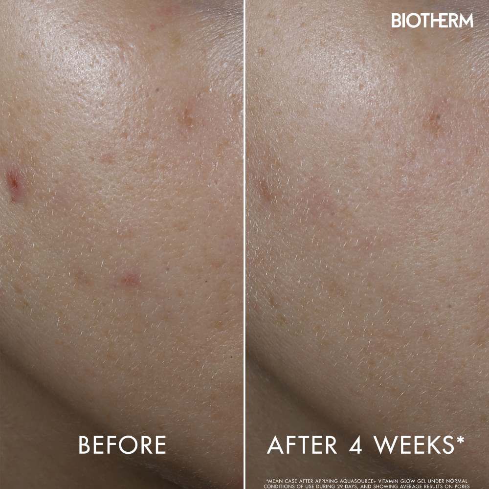 Aquasource+ Vitamin Glow Gel Crema anti imperfecciones